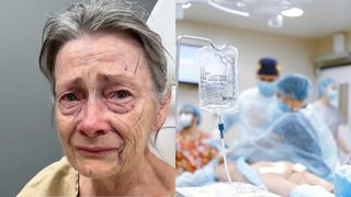 "Arătam ca o femeie de 90 de ani, dar am renăscut după o operație estetică".