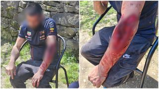 Bărbat atacat de o ursoaică cu doi pui &icirc;n apropierea unui sat din Covasna. A fost rănit grav, dar a supraviețuit