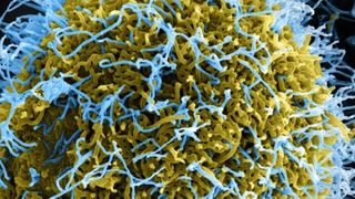 VIDEO Alertă internațională din cauza ebola. Familia unui medic american infectat, izolată &icirc;n Berlin