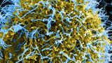 VIDEO Alertă internațională din cauza ebola. Familia unui medic american infectat, izolată &icirc;n Berlin