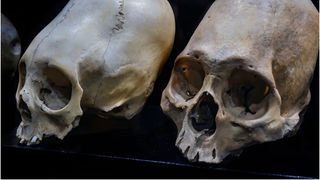 "Ar putea fi extratereștri". Misterul mumiilor "cu cap conic&rdquo; din Peru, ad&acirc;ncit de testele ADN