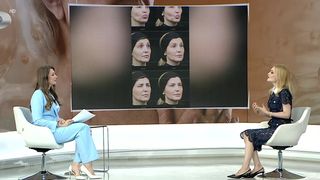 VIDEO Se schimbă trendul &icirc;n materie de intervenții estetice minim-invazive. Recomandările unui medic dermatolog