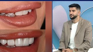 VIDEO &bdquo;Efectele pot să fie destul de rapide&rdquo;. Fumatul, dușmanul danturii