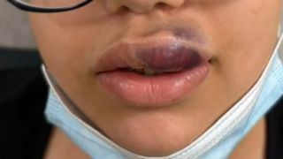 VIDEO Salon clandestin de &icirc;nfrumusețare din Oradea. Femeie reținută pentru injecții ilegale cu acid hialuronic