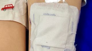 Băiețel de șase ani, ajuns &icirc;n comă la spital după ce sora lui i-a pus pe o zg&acirc;rietură plasturi care conțineau fentanyl