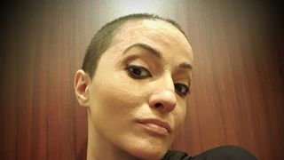 Supravietuitoare in Colectiv, Mariana Oprea picteaza noaptea maini insangerate! Poreclita Tedy, tanara si-a pierdut in tragedie o parte din degete