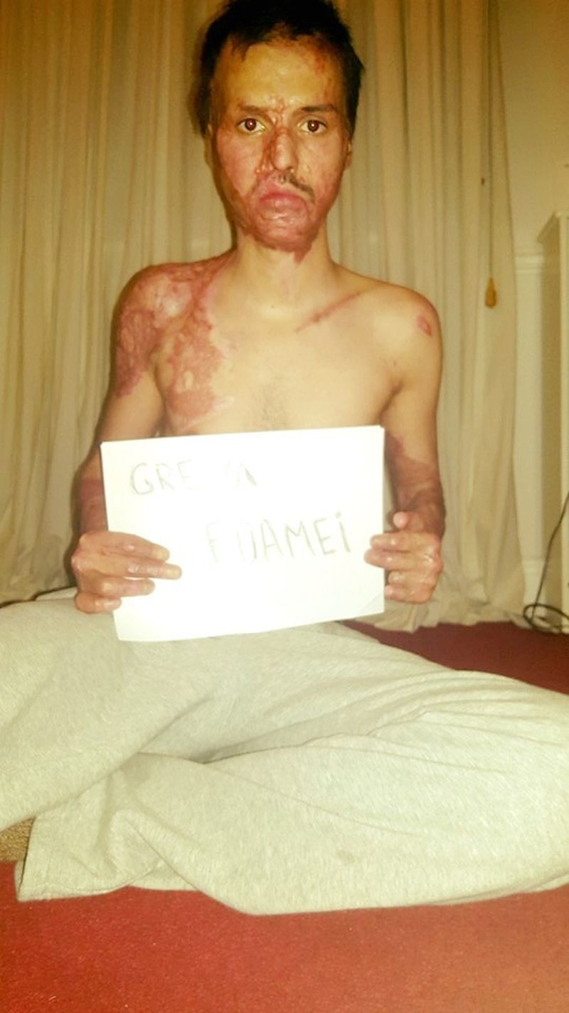 Alexandru e disperat. Mama sa si-a insusit banii primiti de el pentru tratament