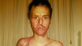 Alexandru e disperat. Mama sa si-a insusit banii primiti de el pentru tratament