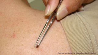 Ploiesti: 51 de oameni au ajuns la spital dupa ce au fost muscati de capuse