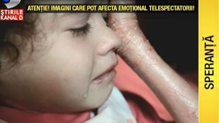 Alexandra, copilul fluture, traieste un cosmar inca de la nastere. La cea mai mica atindegere, pielea ei crapa. Fetita de doar sapte anisori se lupta insa sa triasca