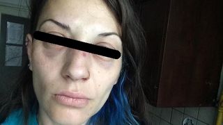 O tanara din Bucuresti a fost snopita in bataie, in Parcul Cismigiu! "Am fost lovita foarte tare la nivelul fetei!"