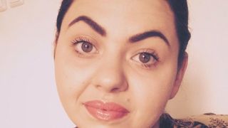 Coregrafa din &ldquo;autocarul mortii&rdquo; e si acum in spital! Alexandra a suferit mai multe interventii chirugicale