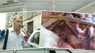 Tudor Stancioiu este medicul care l-a tratat pe barbatul cu larve de la spitalul de arsi. Ce a declarat despre pacientul care a si decedat ulterior