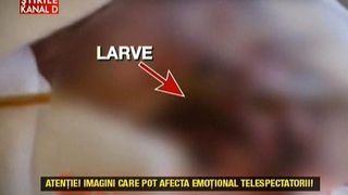 Noi audieri in dosarul pacientului pe care colcaiau viermii. Fiica victimei a vorbit cu anchetatorii