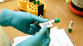 A cazut in capcana unei firme care promite analize gratuite, iar apoi te pune sa platesti daune de mii de lei. Echipa Stirilor Kanal D, bruscata: "Iesiti afara, va sparg camera".