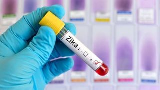 Al treilea caz de infectare cu virusul Zika in Romania. Este vorba despre un barbat de 36 de ani din Cluj-Napoca