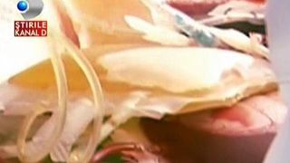 Incredibil, dar adevarat: inca o pacienta a primit o transfuzie GRESITA de sange!