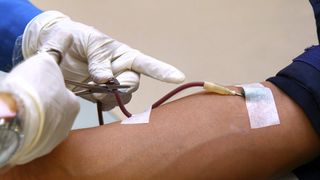 Ce se intampla in cazul unei transfuzii de sange gresita. "De regulă apar reacţii de tip alergic, &icirc;n cazuri foarte rare apar hemoragii masive"