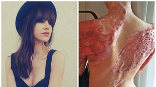 Alexandra Furnea, fotografie dura pe Facebook, la 9 luni dupa tragedia din Colectiv: "O pereche de "aripi" piezise care inca mai dor"