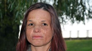 Pictorita desfigurata de o explozie arata astazi incredibil! Daniela Baloi are 34 de ani, este din Bumbesti-Jiu si a avut deja o expozitie la muzeul judetean!