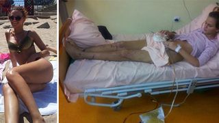 Tanara cu trup de manechin, sfartecata intr-un accident rutier, a reusit sa alerge dupa doi ani de la tragedie! &ldquo;Primii pasi, alergand! Doamne, ce sentiment!&rdquo;