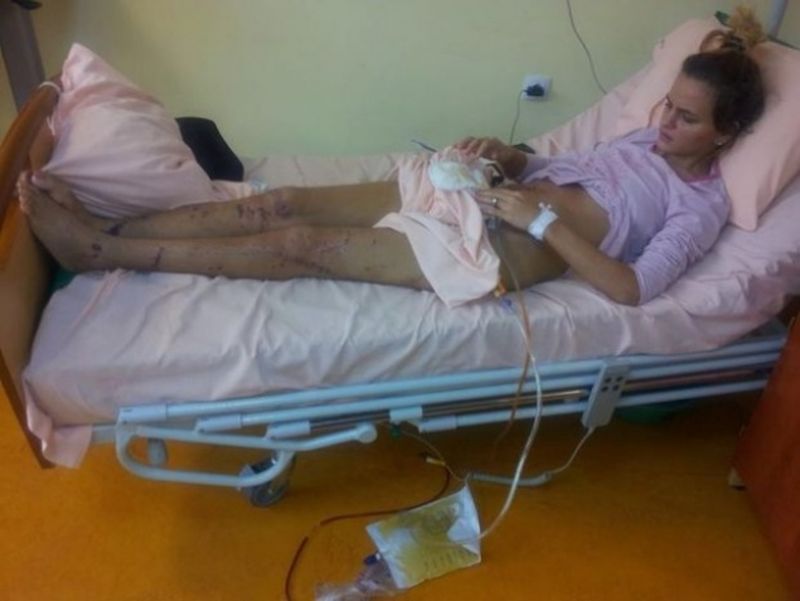 Tanara a stat luni bune in spital si a suferit sapte operatii