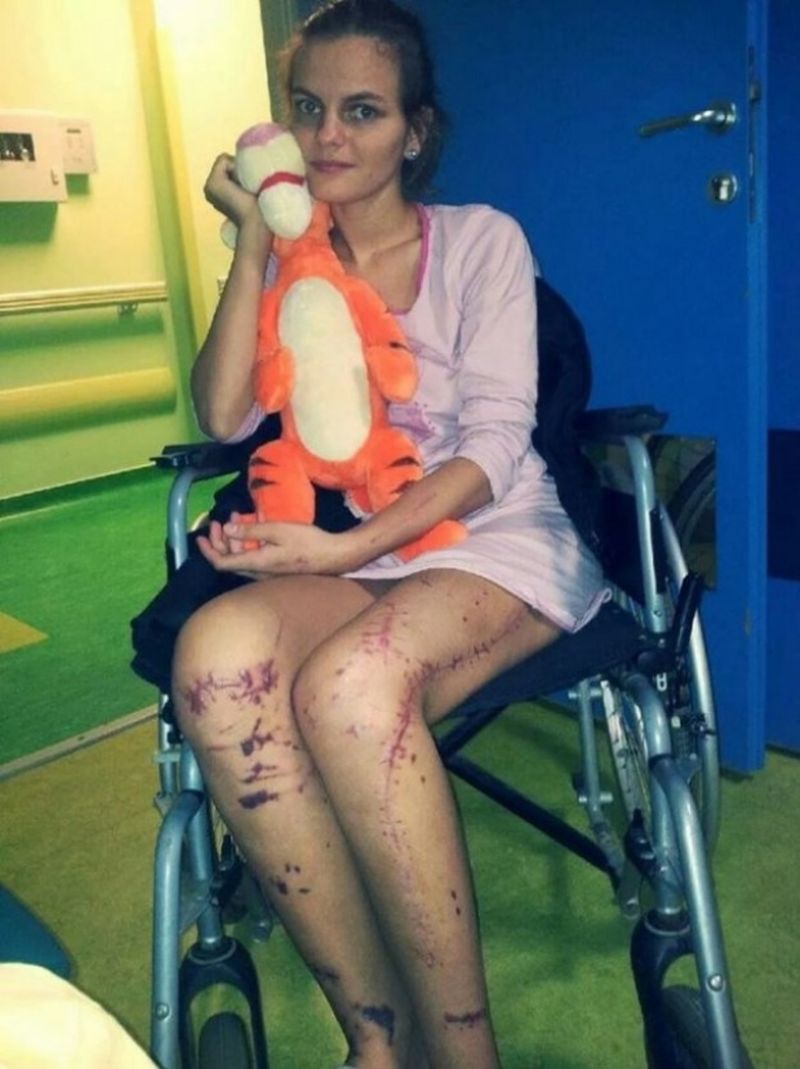 Nicoleta, dupa accident