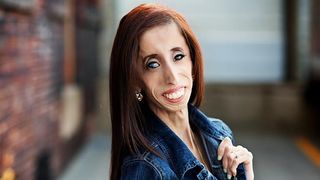 Marturii infernale. A fost batjocorita si numita "cea mai urata femeie de pe Planeta". Cu toate astea, a mers mai departe si le-a dat o lectie de viata tuturor celor care au umilit-o