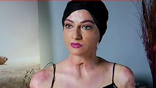 A ramas mutilata in urma tragediei de la Colectiv, dar inca mai are putere sa zambeasca. Teddy: Nu imi vine sa cred ca m-am facut bine intr-un timp atat de scurt