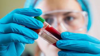 Focar de hepatita intr-o comuna din Mehedinti. Paisprezece persoane au fost internate in spital