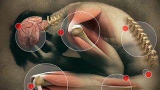 Medic: Bolile reumatice determină, anual, un cost de 240 de miliarde de euro la nivelul UE, echivalentul a 2% din PIB