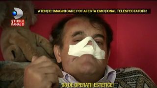 O boală misterioasă, nemai&icirc;nt&acirc;lnită p&acirc;nă acum, i-a mutilat faţa! Este explicaţia unui medic chirurg, dat &icirc;n judecată de un gorjean,după ce l-ar fi nenorocit pe viaţă.