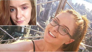 O fata de 23 de ani si-a distrus corneea dupa ce a purtat prea mult timp lentile de contact. Cum arata ochiul tinerei acum