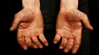 Botosani: Cadre medicale gasite murdare pe maini de materii fecale