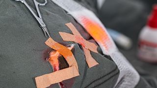 Olt: Trei adolescenti raniti dupa ce un microbuz in care se aflau mai multi copii a derapat si s-a rasturnat