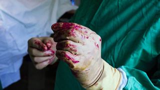 "Oricum murea. Esti tanara, poti sa faci altul" i-a spus medicul Burnei unei mame a carei fiica i-a murit pe masa de operatii