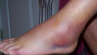 Vaslui: Un elev de 12 ani si-a lovit profesoara de romana cu o teava peste picioare. Femeia, de 29 de ani, a ajuns la spital plina de vanatai