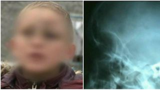 Starea baiatului de 14 ani care ar fi fost batut de primarul unei comune din Tulcea s-a agravat. Ce spune edilul acuzat ca l-a rupt in bataie