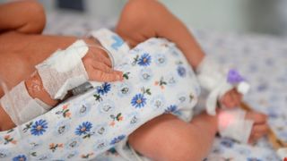 Un bebelus de zece luni cu rujeola a fost internat in stare grava la spital