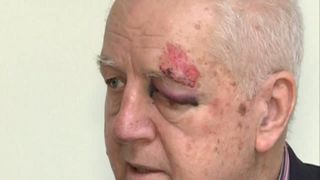 Chinurile lui Jean Padureanu! Fostul presedinte al Gloriei Bistrita, decedat astazi, fusese batut de un necunoscut acum patru ani, in Capitala