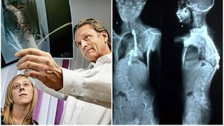 Marturia medicului german care a consultat zeci de copii operati de medicul Burnei: "Pur si simplu groaznic"