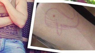 Mai multi elevi din Arges s-au automutilat! Sa fie noi victime ale jocului Balena Albastra