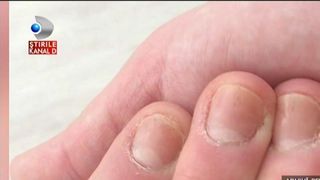 Cosmarul unei tinere care a ramas fara unghii din cauza ojei cu gel!A ramas fara jumatate din unghii. Nu suporta apa calda pe ele si urla de durere la cea mai mica atingere