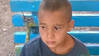 Nevoie urgenta de sange pentru baietelul de 8 ani, atacat de caini. Are nevoie de zeci de operatii pentru a-si reveni