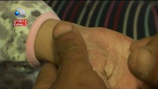 Povestea care te lasa fara grai. Are doar 5 anisori si nu isi poate atinge sora, pentru ca o raneste. Pielea ii este crapata si plina de coji groase. Anastasia are nevoie de ajutorul nostru