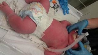 O femeie a nascut un prunc de aproape 8 kilograme! Cum arata micutul urias