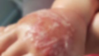 Socant! Bebelus trimis acasa cu mana umflata si infectata de la o branula