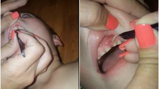 Motivul pentru care nu trebuie sa iti lasi copilul sa isi roada unghiile! Ce a scos o mama din gingia fiului ei