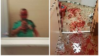 "Nu a spus nimic, doar ma lovea". Un barbat din Alba Iulia, lasat intr-o balta de sange in toaleta unui bar - Victima il cunoaste pe agresor: "E chel si are 1.80 metri"