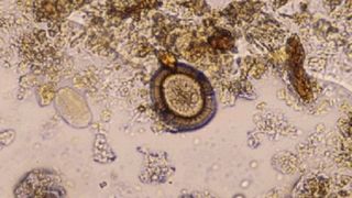 Raportul dezastrului despre apele din Romania! Sunt contaminate cu resturi animale, grad de infectare cu E-coli peste limita admisa